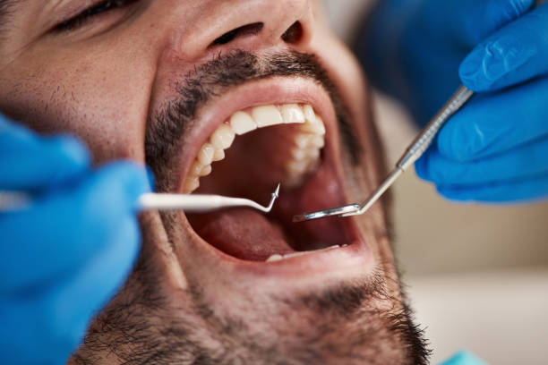 Best Tooth Infection Emergency Dentist  in St James City, FL